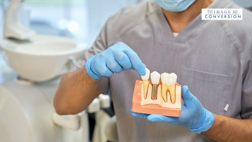Pterygoid Implants