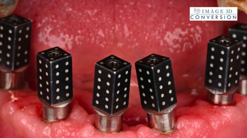 Photogrammetry Technique in Implant Dentistry