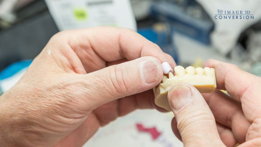 Should Dentists Trust 3D Printed Crowns