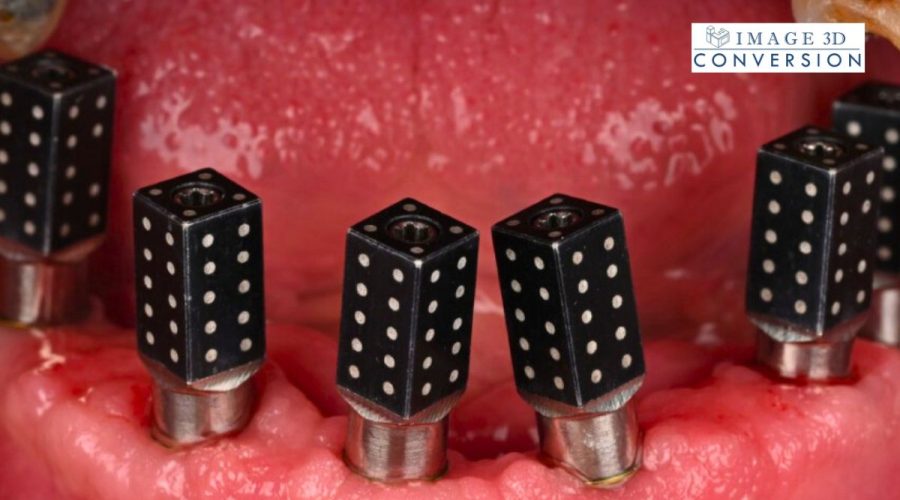 Photogrammetry Technique in Implant Dentistry