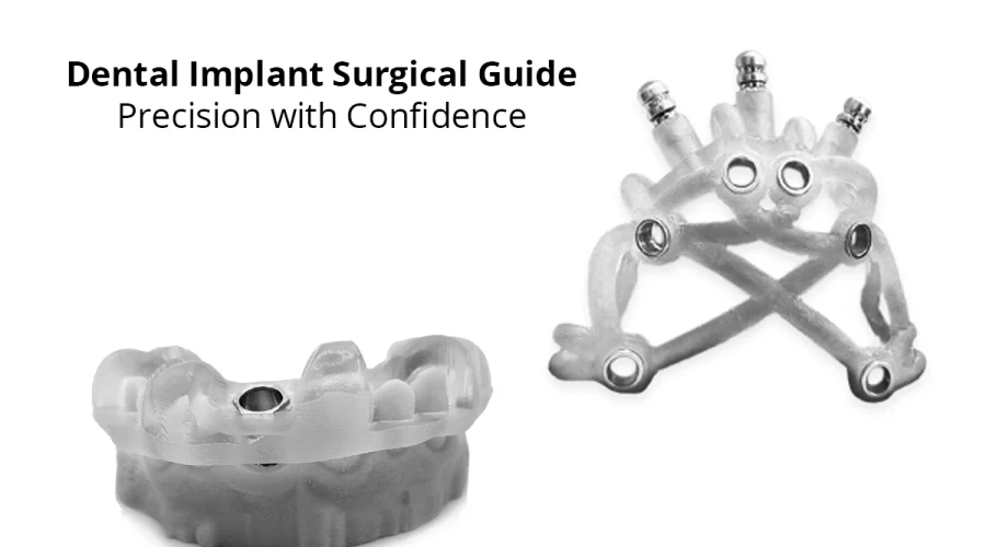 dental-implant-blog-post dental-implant-blog-post