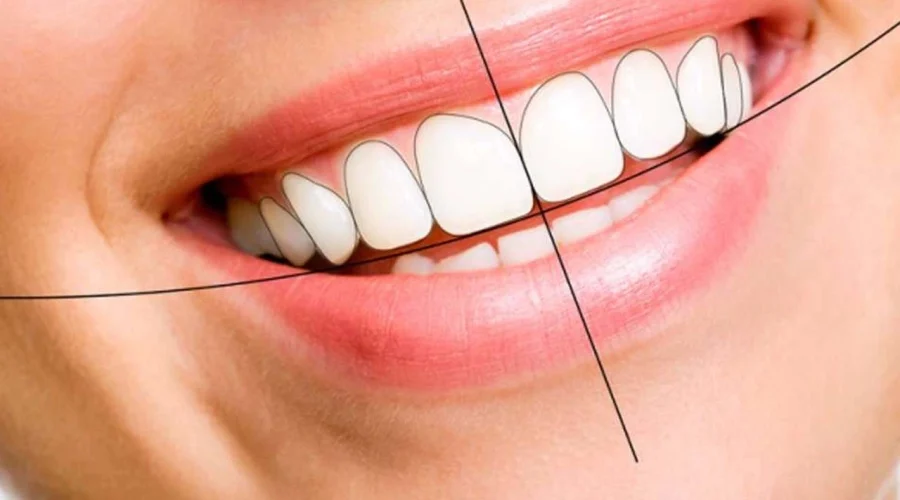 digital-smile-design