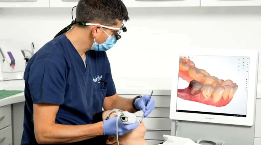 intraoral-scanners