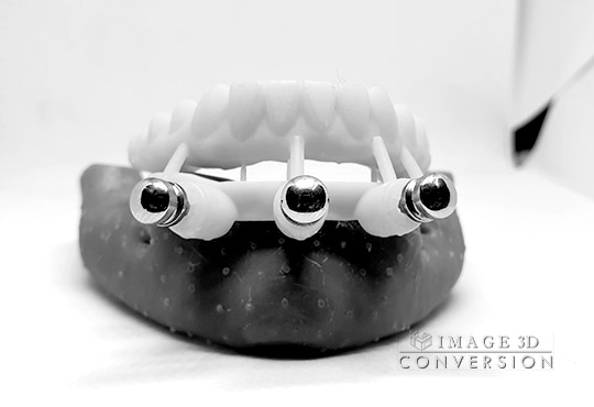 image3dconversion i3d CBCT to STL computer guided surgery DICOM to STL	Dental Implant Digital Dentistry Restorative dentistry