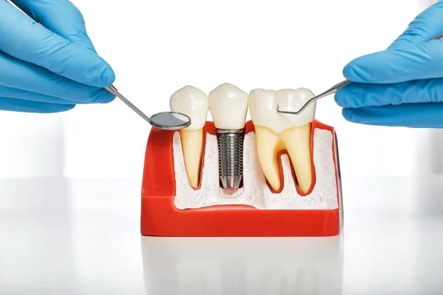 comprehensive-guide-dental