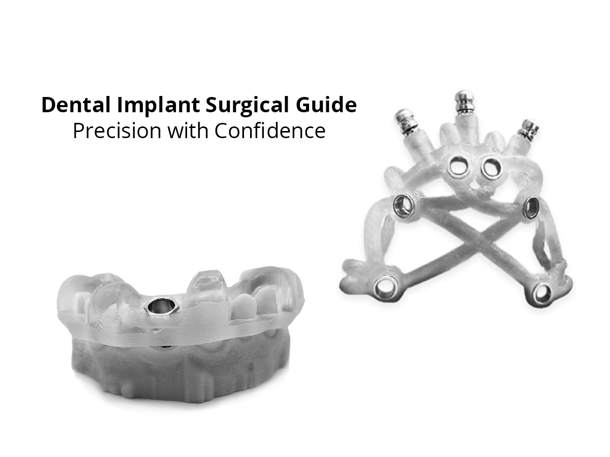 dental-implant-surgical-guide
