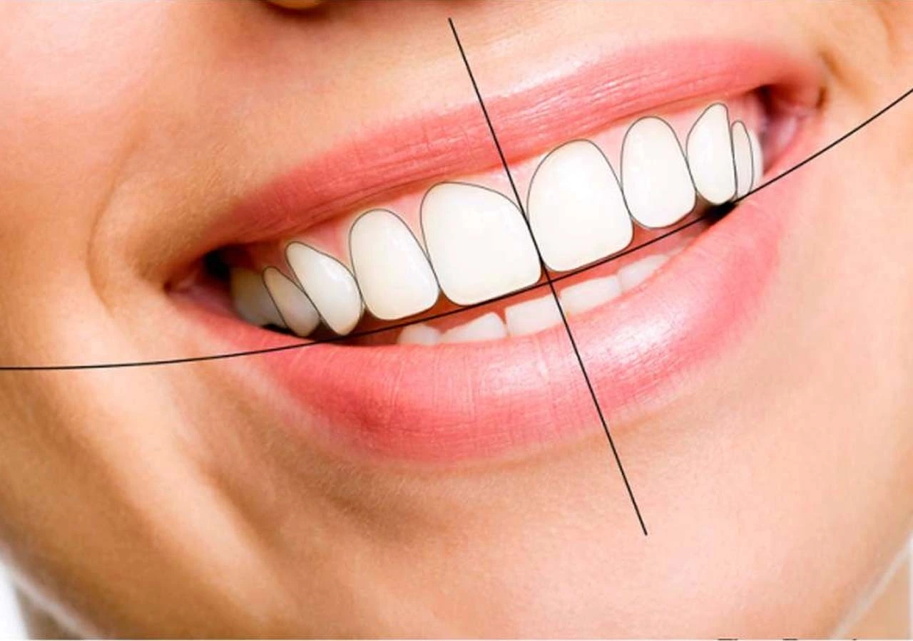 dental-implant-with-digital-smile-design-planning
